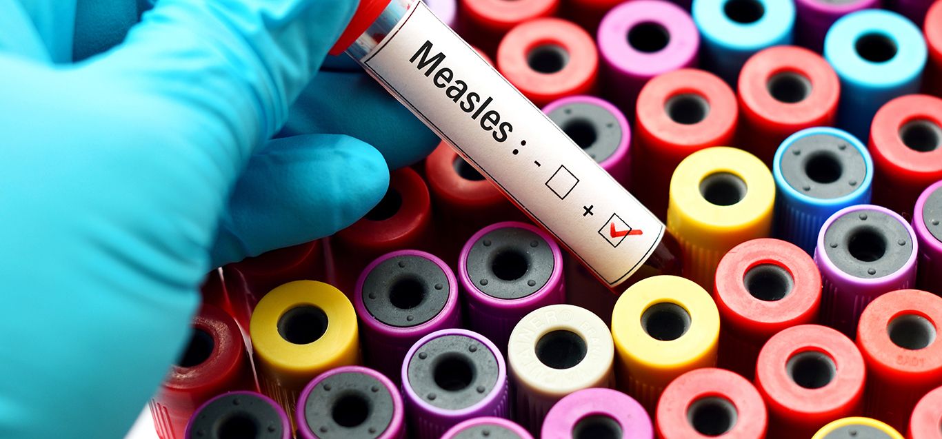 Measles: Understanding the Symptoms, Risks and Prevention Strategies