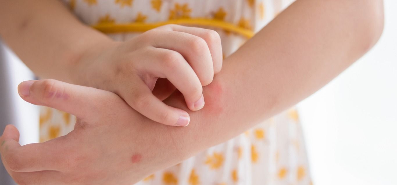 Bumps and Rashes: Common Skin Conditions Explained