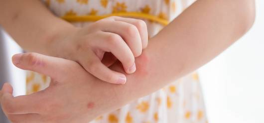 Bumps and Rashes: Common Skin Conditions Explained