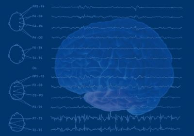 Brain Tumors and Epilepsy