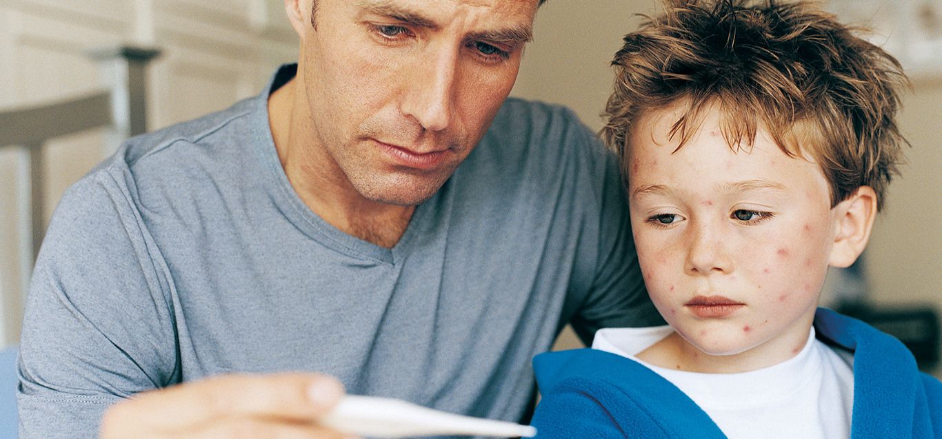 Chickenpox 101: Symptoms, Risks and Prevention