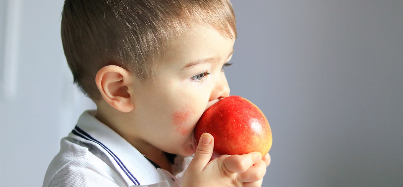 Allergy or Intolerance? How to know the difference.