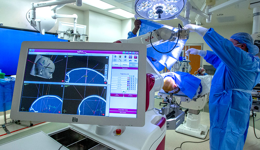 Stereoelectroencephalography (SEEG), Neurological Surgery